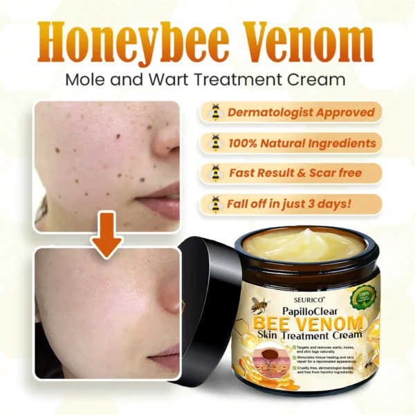 Clearance Blowout ! Enjoy 50% Off Bee Venom Mole and Wart Cream